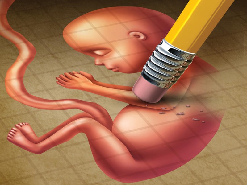 Screening for Recurrent Miscarriage